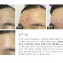 멀티팜 이미지