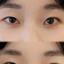 더모먼트 이미지
