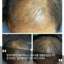 브니엘 헤어 이미지