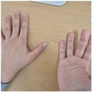 20235508 김예지 의안과제(2) 이미지