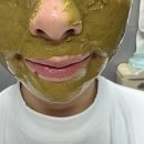 제미안 | 피코토닝 vs 장희빈미안법 비교 후기
