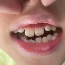 의정부연세이예쁜치과교정과치과의원 | 태완 의정부 연세이예쁜치과 교정 이야기