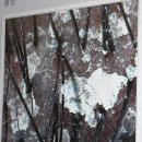 웰킨 두피 탈모 센터 | 청라 두피관리 웰킨 두피탈모센터 후기