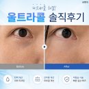 이레피부과의원 | 눈밑꺼짐 울트라콜 솔직 후기 (통증, 붓기, 일주일 경과)