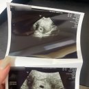 보건소 | 평택 송탄보건소 임산부등록 후기ㅣ정부지원 혜택과 산전검사 정보 정리