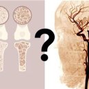 골밀도 낮은 게 '뇌혈관'과 관련 있다고? 이미지