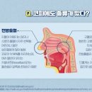 코피 자주나는 이유 코피원인 지혈 예방 치료 이미지