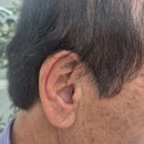 하나히어링보청기 동대문센터 이미지