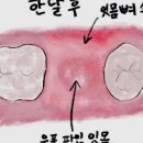 라페치과의원 교하점 방문 후기 – 신뢰와 안전을 느낀 치아 치료 경험이에요!