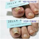 젤리네일 이미지