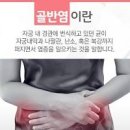 여자 골반염 초기 증상 만성 원인 치료 통증 이미지