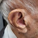 스타키보청기 안동점 이미지