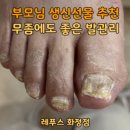 파킨슨, 고지혈증이 있으신 아버님의 대힐링♥ 부모님선물 추천 레푸스 발관리