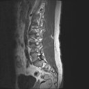 엠알아이 이미지