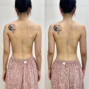 노바사 | 대구등관리 잘하는 곳 테라노바 후기 풀로채에스테틱 3회차