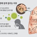 노인, 감기로 착각해 &#34;폐렴&#34; 방치했다가 사망까지.... 이미지