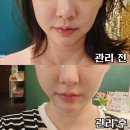 일산 주엽역 에스테틱 샤론뷰티토탈샵 얼굴경락 후기