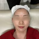 광교천 | 광교에스테틱 추천 [루비엔에스테틱]에서 천방케어 받은 후기