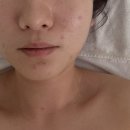 에스더코스메틱 | [명일역 피부관리실 추천] 명일역 에스더스킨앤바디에서 시그니처 관리 후기