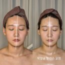 위례피부관리 디유에스테틱 셀럽 포토샵 윤곽리프팅 케어 솔직 후기