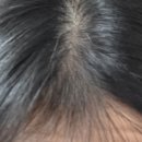 헤어온의원 이미지