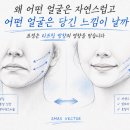 연세더바로성형외과의원 네이버블로그