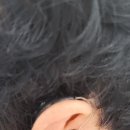 메아리 보청기 이미지