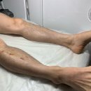 왁싱하리 - 강남구 선릉로 431 | 성신여대 돈암동 왁싱하리 남자 왁싱 내돈 내산