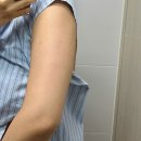 11650-17-102-5 | [Beauty] :: 지방분해주사 후기 윔클리닉에서 미우핏 3회로 팔뚝살 빼는법