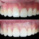 이세상치과기공소 이미지