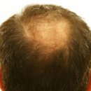 두피모발 관리사  (자격증반) 이미지