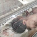 주식회사 코벨트 | 임신 37주 조기출산 ㅣ 강남차 제왕절개 후기 • 응급제왕 후기 • 최준식 교수님