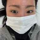 4190 | "두류역 래쉬올린" 힘없고 처진 속눈썹 펌 후기