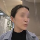 뉴에이징의원 | [중랑구피부과] 바이린의원 슈링크 유니버스+볼뉴머 리프팅 '볼링크' 찐후기(+제네시스·피코토닝)