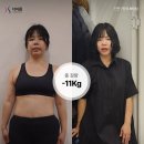 더마름다이어트 이미지