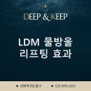 수지구청피부과 스킨딥의원에서 진행하는 LDM 물방울 리프팅 효과 이미지