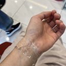 산본피부비뇨기과의원 | [선릉 힐 피부비뇨기과 의원] 선릉 잡티제거 후기 강남 색소 레이저