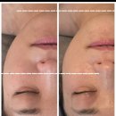 뷰티마차 | 구산역 셀럽뷰티어겐 후기｜붓기·승모·열감까지 잡아주는 휘게 에스테틱 찐관리