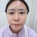 정이브로우 이미지
