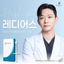 프로젝트유의원 | 레디어스 필러가 볼륨에 미치는 효과(실제 시술 후기 O)