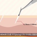 J헤어라인