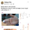 윤석열이 수행원으로 두고 있는 것 같다는 ‘항문침’ 전문가 이미지