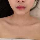 삼산동 피부관리‘더 스테이 에스테틱’ 작은 얼굴 윤곽관리받고 온 후기