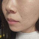 비카디 | 카디비 PICK 올영 필링젤 닥터멜락신 모공케어 후기