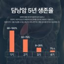 증상도 없이 찾아 오는 '담낭암 이미지