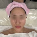 군산피부관리 라끄스킨케어 애씨큘물광필관리 후기