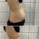 태크니끄 해운대 셀핏 프리미엄 | 태크니끄 해운대 셀핏 프리미엄 해운대바디관리 찐만족후기