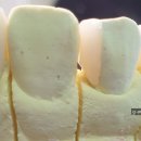 지안치과기공소 이미지