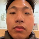 김포 구래동 모공전문관리 / 초이스뷰티 방문후기