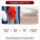 골관절염치료기